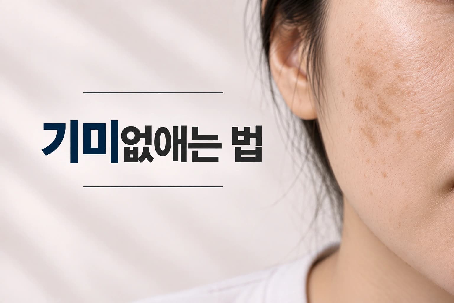 볼에 넓게 퍼진 갈색 기미를 보여주는 기미없애는 법을 알려주는 썸네일
